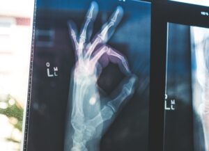 Para este texto titulado: Salud y seguridad: productividad en el trabajo, tenemos como imagen destacada la radiografía de una mano haciendo el signo de excelente.